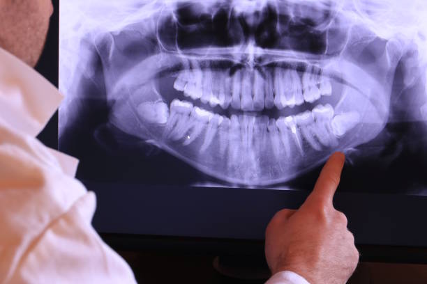 Best Emergency Treatment for Toothache in Kean University, NJ