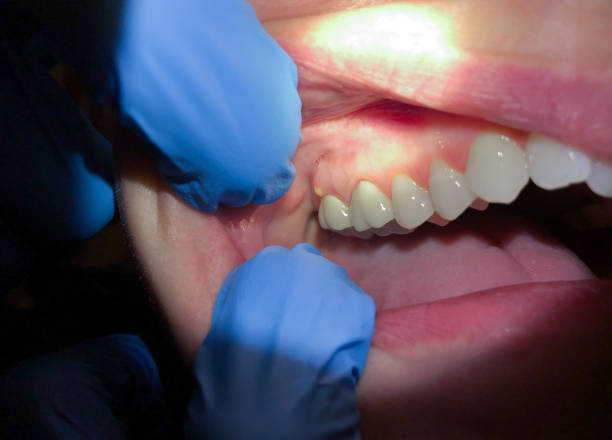 Best Emergency Dental Care for Trauma or Injury in Kean University, NJ