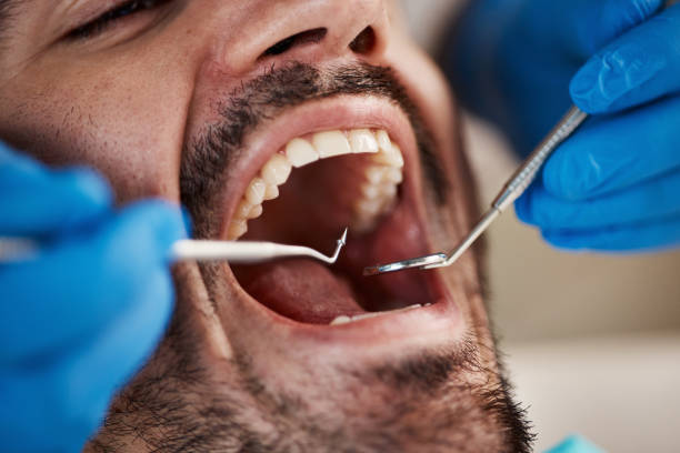 Best Emergency Treatment for Toothache in Kean University, NJ